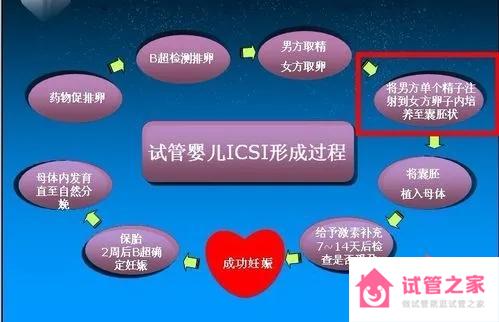 試管嬰兒ICSI形成過程示意圖