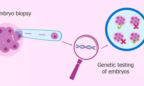 三*試管是移植前篩查技術(shù)