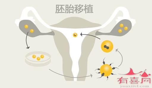 做試管嬰兒女性遭罪嗎