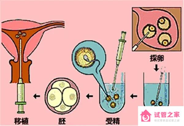  胚胎移植失敗后多久可以再次移植