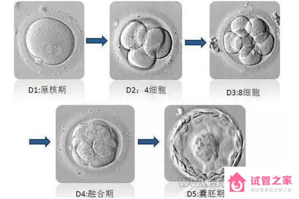 美國(guó)第三*試管嬰兒的認(rèn)知誤區(qū)有哪些