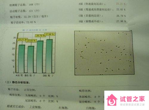 精液常規(guī)檢查結(jié)果圖