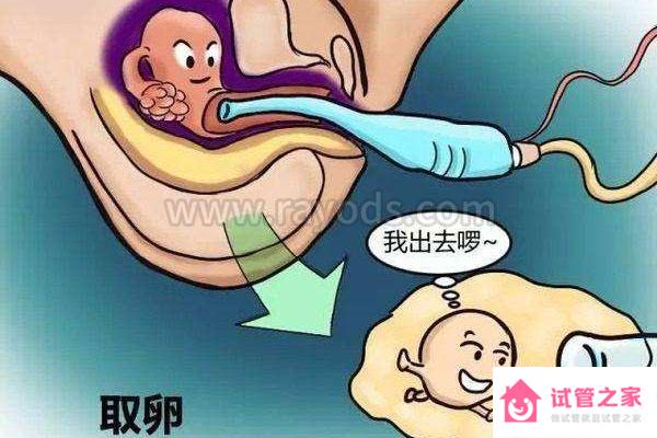 試管嬰兒取*