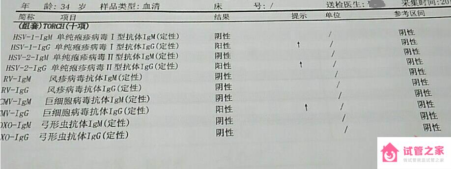 優(yōu)生十項(xiàng)檢查結(jié)果怎么看