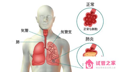 艾滋病自查的10個方法，檢測方法并不難