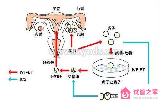 第三*試管嬰兒就會適合你嗎？這些區(qū)別你一定要知道！