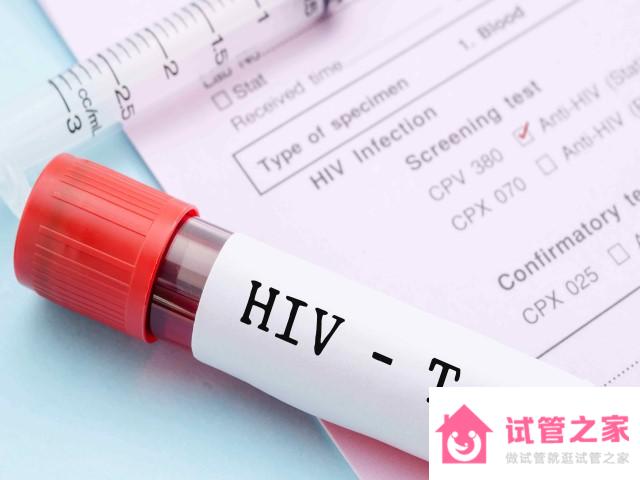 HIV攜帶者想健康生孩子可以在廣州八院做試管嬰兒嗎？