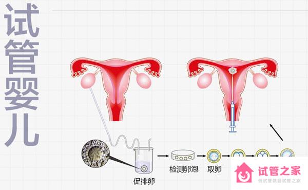 試管嬰兒移植前打降調針有哪些作用？