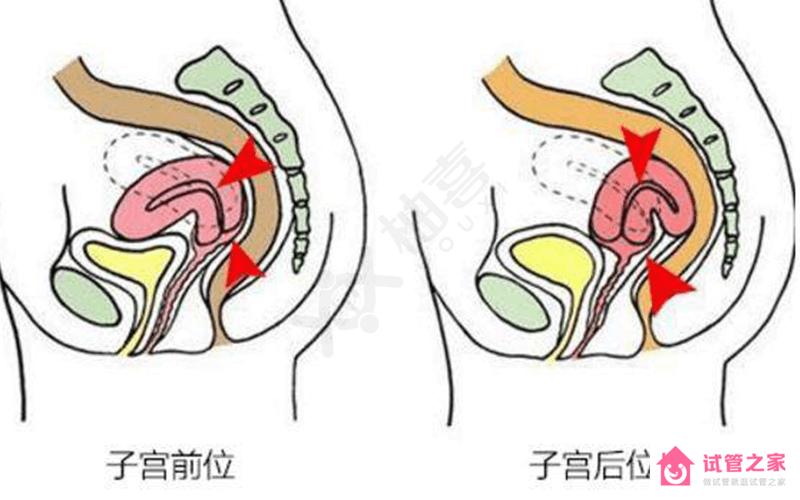 子宮前位不影響懷孕幾率！不過它的優(yōu)缺點得知道