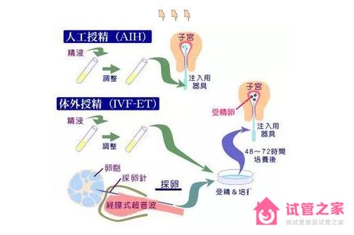 第三*試管嬰兒和一*二*的區(qū)別