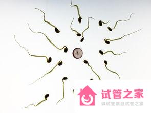 試管嬰兒可以買精子嗎？試管嬰兒對(duì)精子有什么要求？