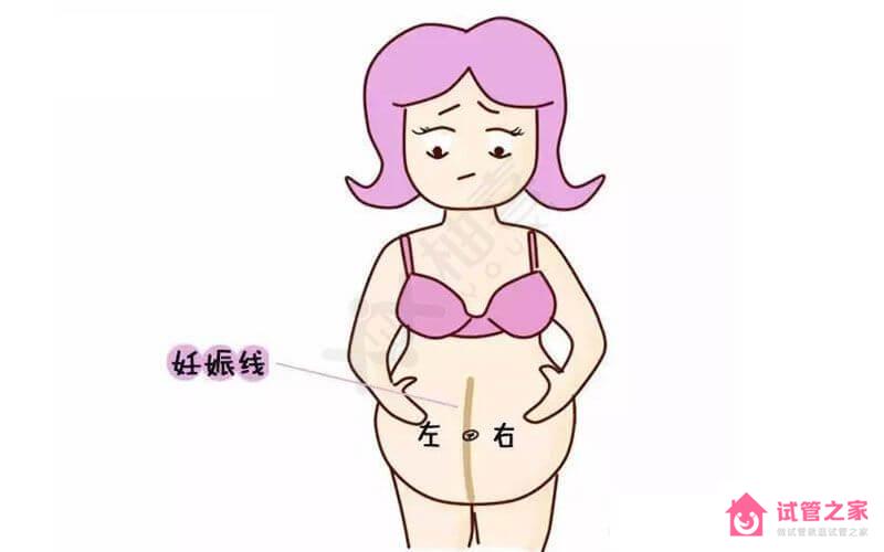 妊娠線變淡生女孩經(jīng)驗(yàn)之談，三招巧看胎兒性別