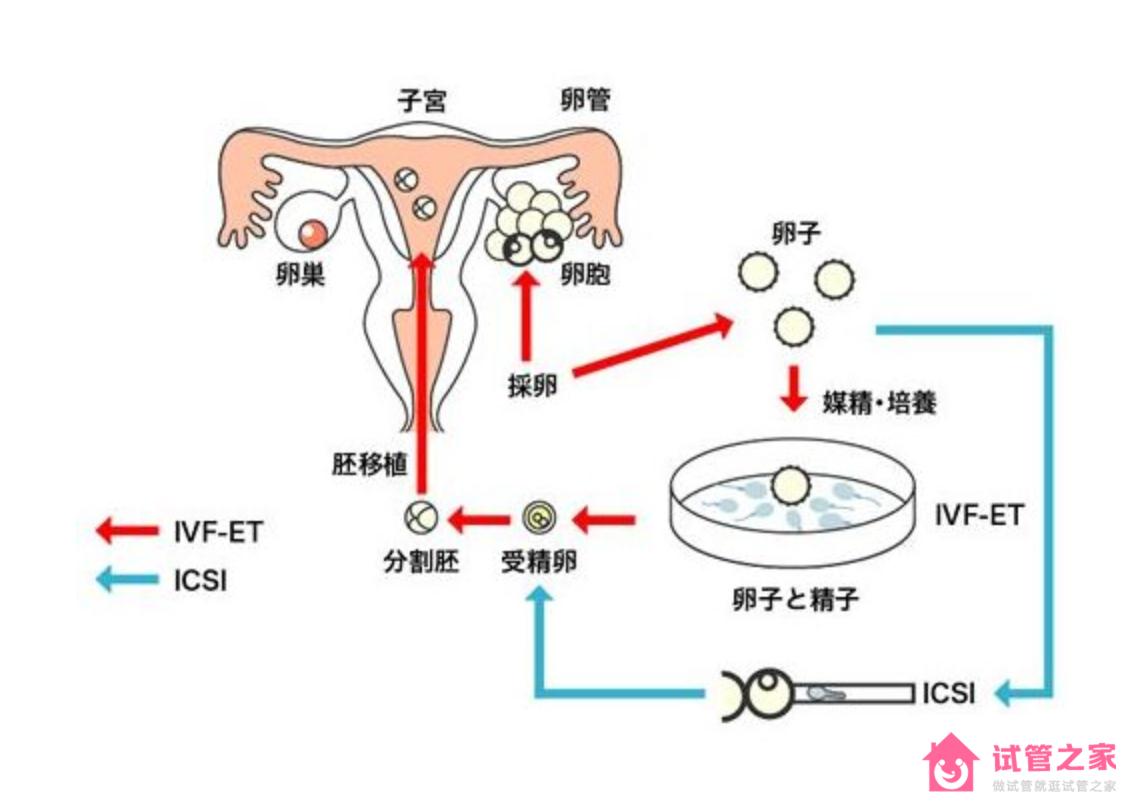 超詳細(xì)的泰國試管嬰兒攻略大全