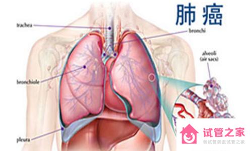 不影響壽命的十大癌癥，這些是可治愈的癌癥