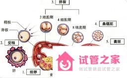 試管嬰兒胚胎如果著床位置不對，會發(fā)生什么？