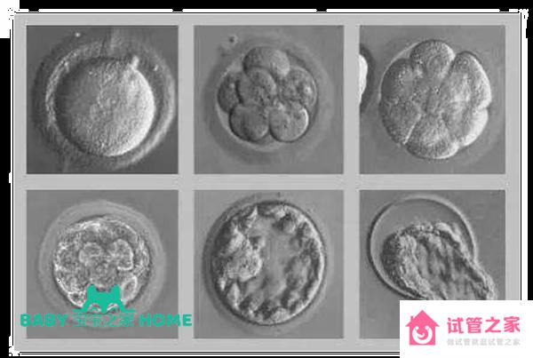 37歲高齡做試管放3個(gè)胚胎可以增加著床成功率嗎？
