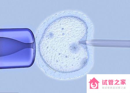 上海婦幼保健院試管嬰兒費(fèi)用要多少？附2022上海試管生男孩費(fèi)用一覽表 ...