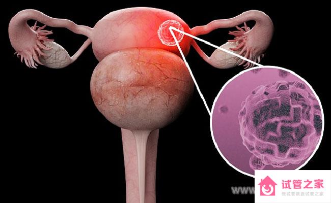 四維彩超到底能不能看處宮腔環(huán)境好不好呢？