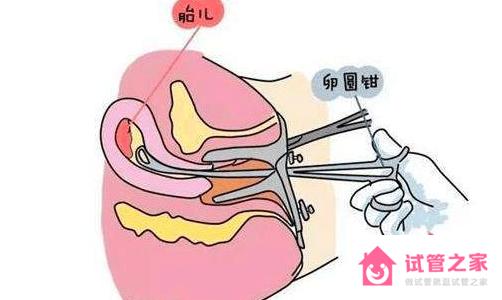 打胎需要準備什么證件