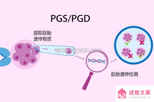 先天性輸精管缺如，去泰國做試管嬰兒如何成就“爸”業(yè)？