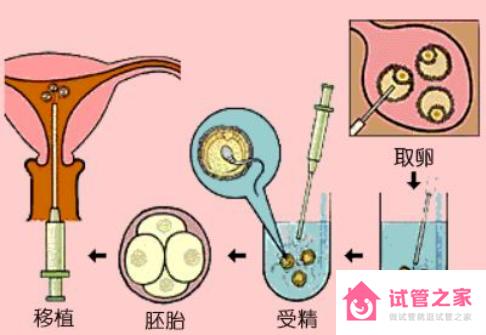 試管成功率如何才能到達(dá)100%？