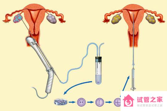 哪些人做試管嬰兒成功率高