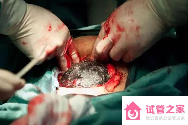 46歲高齡產(chǎn)婦生孩子危險還老的快，別拿健康和生命當(dāng)兒戲