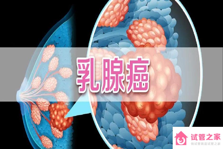 做試管打促排針會得乳腺癌嗎？醫(yī)生的答案會讓你放心