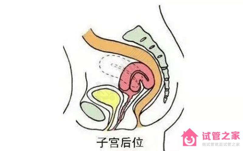 子宮后位不要慌！照這4種方法備孕保你提高受孕率