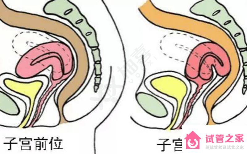 子宮后位不要慌！照這4種方法備孕保你提高受孕率