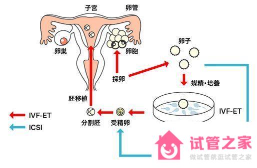 試管攻略｜試管嬰兒胚胎移植1個(gè)好還是2個(gè)好？