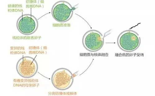 第四*試管嬰兒是什么技術(shù)？