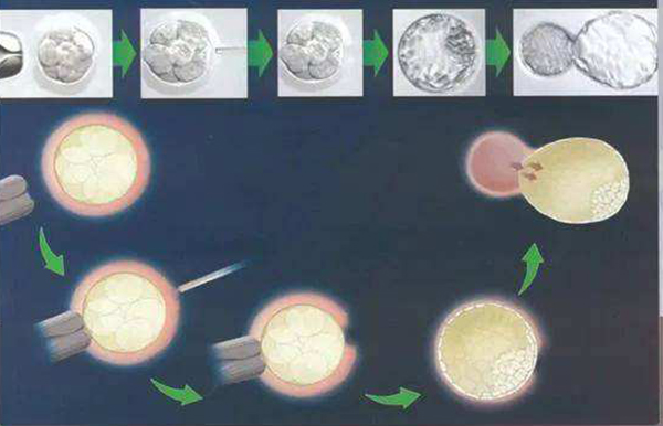 什么是早期胚胎輔助孵化透明帶激光打孔術？