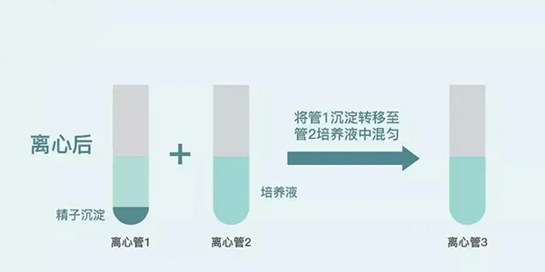 人工授精是如何洗滌男性精子的？求操作流程分享！