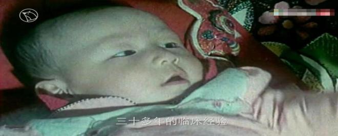 34年前，我國第一例試管嬰兒成功后，孩子后來怎么樣了？