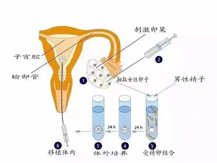 第一*、第二*、第三*試管嬰兒技術(shù)，該怎么選？