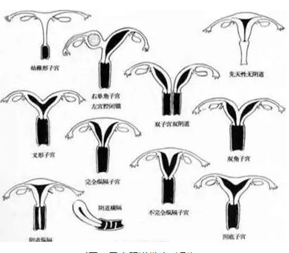 “石女”能結(jié)婚生子嗎？