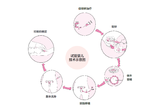 輸*管不通？這該怎么治療？