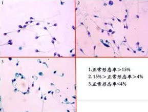 精子質量對胚胎發(fā)育還是有不少影響的！