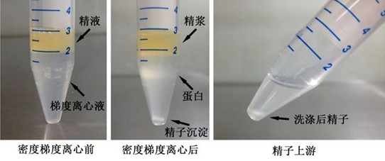 輔助生殖技術(shù)中精液是怎么優(yōu)化的？