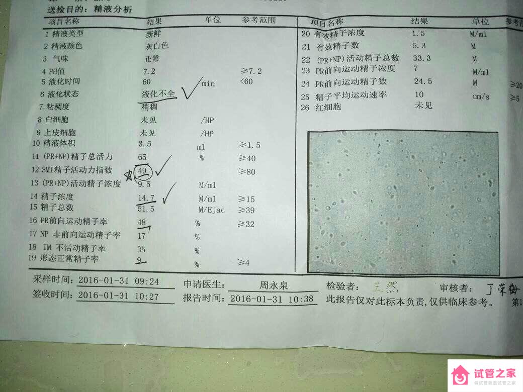 2023清遠試管嬰兒醫(yī)院排名，老司機談供精助孕經歷