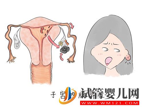 子宮內(nèi)膜異位癥——痛經(jīng)的一種常見病因