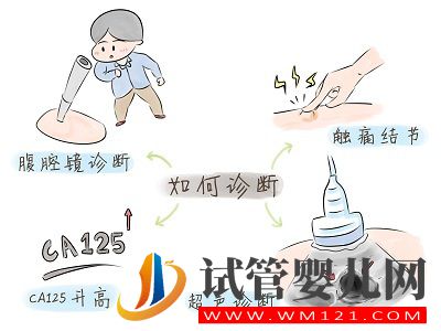 子宮內(nèi)膜異位癥——痛經(jīng)的一種常見病因