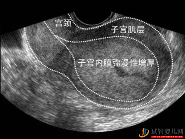 amh0.34儲(chǔ)備功能還沒(méi)衰竭