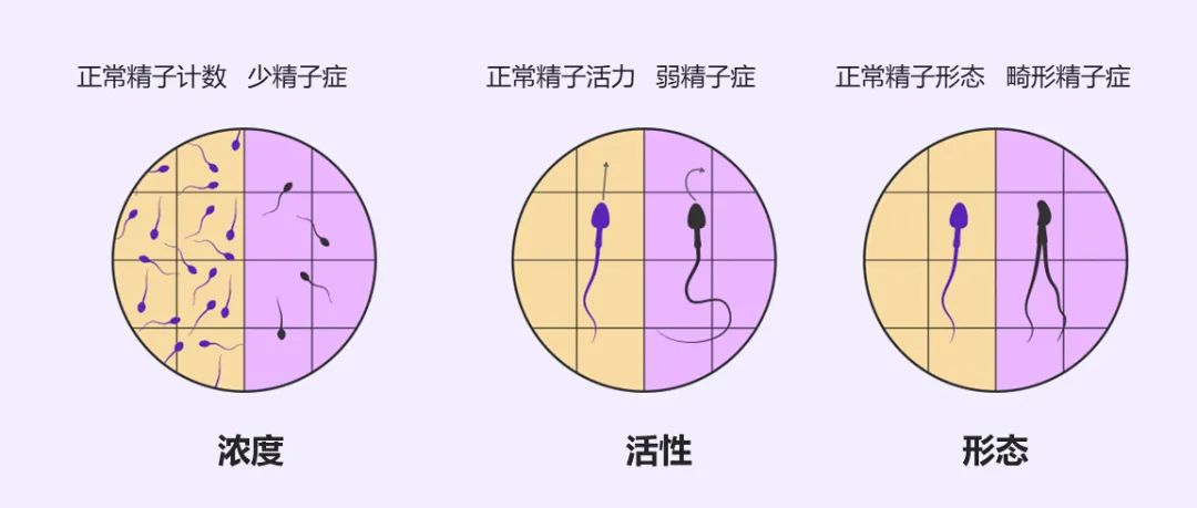 精子冷凍后是否會(huì)影響到試管嬰兒助孕的成功率？精子冷凍后試管嬰兒的成功率高嗎 ...