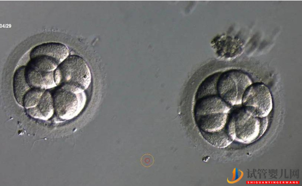 2pn胚胎是不是優(yōu)質(zhì)胚胎？移植成功率說明了一切