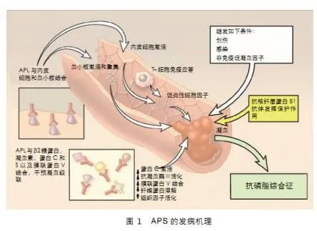 做試管嬰兒前是否有必要檢查自身免疫抗體?自身免疫抗體對(duì)妊娠結(jié)局的影響及分析 ...