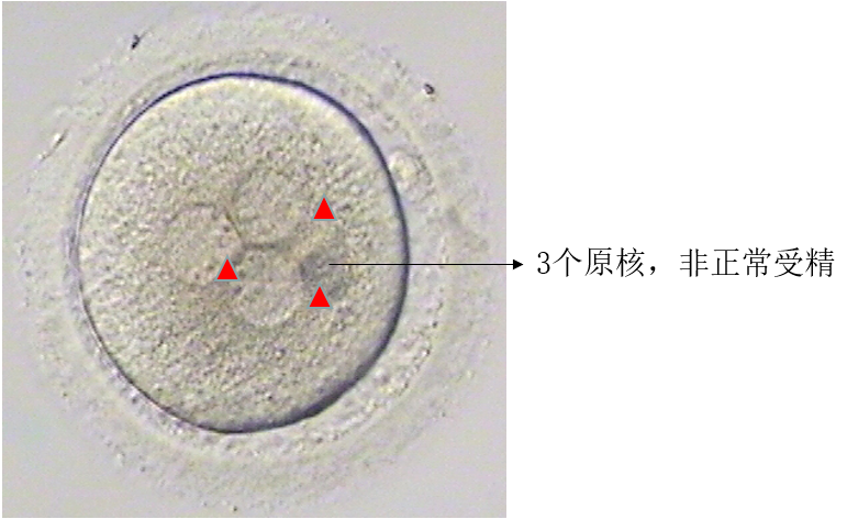 試管嬰兒胚胎的發(fā)育過程，胚胎的評估與試管嬰兒成功率的關系 ...