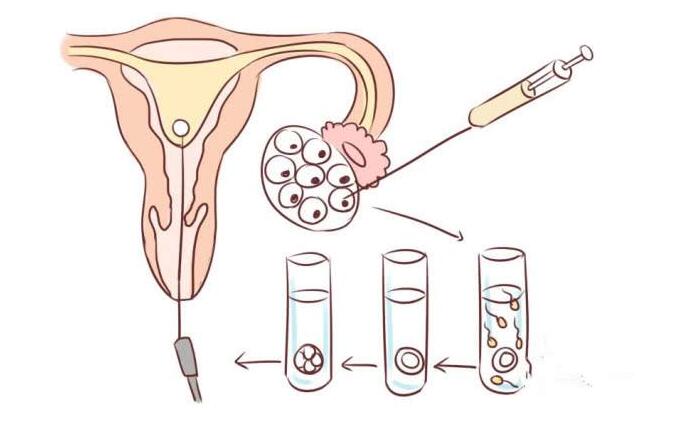 試管嬰兒胚胎移植成功率與哪些有關？試管嬰兒胚胎移植前后的注意事項 ...