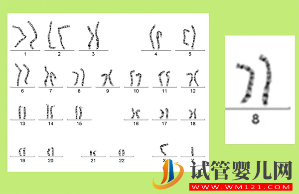 8號染色體異常會怎樣 - 偏多、缺失、三體是什么原因